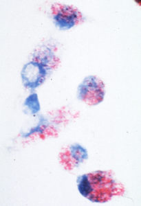 MAP bacteria in macrophages